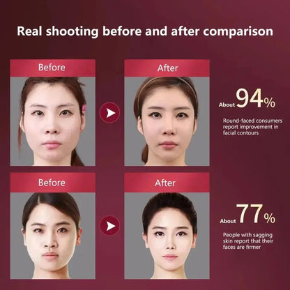 LED Photon Therapy Facial Slimming Vibration Massager Reseller