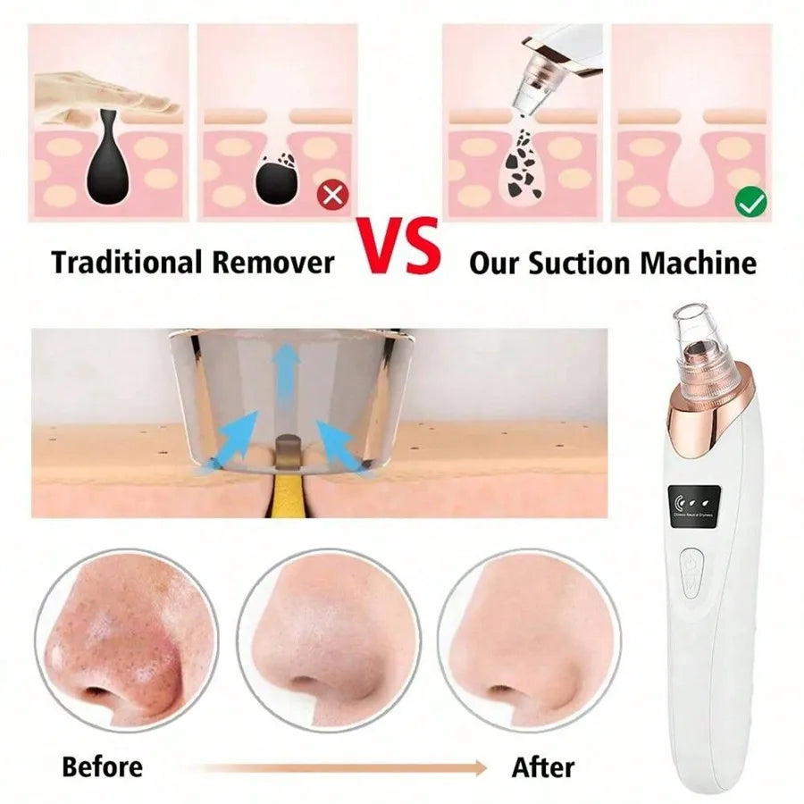 Electric Facial Blackhead Vacuum Remover – Deep Pore Cleansing Tool for Skin Care & Pore Refining